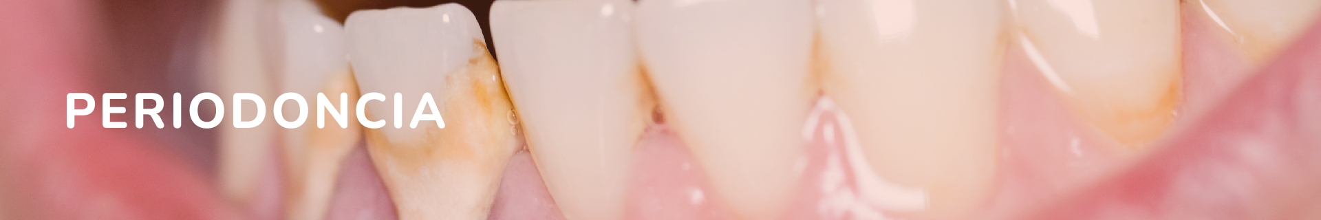 MENU PERIODONCIA